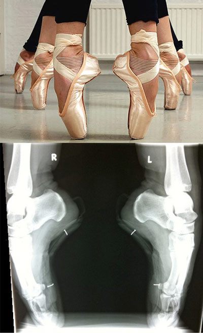 mpaleto-mia-texni-gia-dynates-gynaikes-e-podi-picture-08