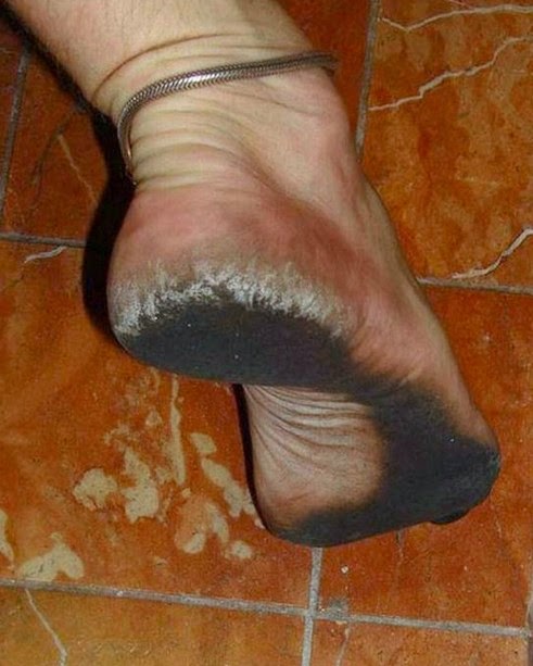 exei-na-foresei-papoutsia-e-podi-picture-02