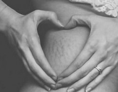 #LoveYourLines: Εκστρατεία υπέρ των ραγάδων!