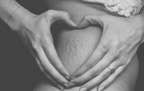 #LoveYourLines: Εκστρατεία υπέρ των ραγάδων!