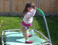 Γεννήθηκε χωρίς τα οστά της κνήμης