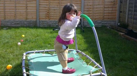 Γεννήθηκε χωρίς τα οστά της κνήμης