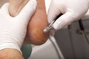 skasmenes-pternes-i-ragades-e-podi-picture-03