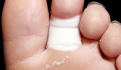 Άσπρα, κόκκινα, μπλε δάχτυλα