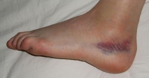 diastremma-podoknhmikh-e-podi-picture-02