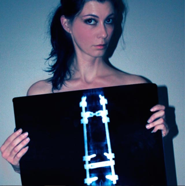 otan-i-parapligia-ginetai-xoros-e-podi-picture-02