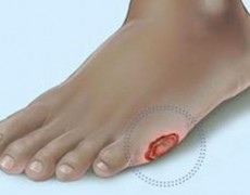 Πληγές που δεν επουλώνονται