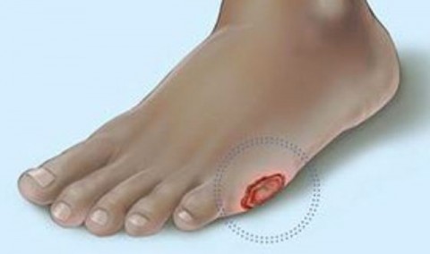 Πληγές που δεν επουλώνονται