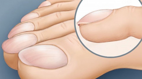 Πληκτροδακτυλία