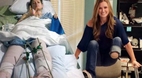 Της ακρωτηρίασαν το πόδι μετά από μαραθώνιο και κατάφερε να ξανατρέξει