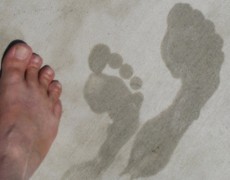 Υπερεφίδρωση