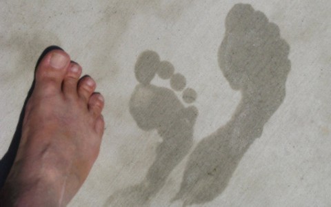 Υπερεφίδρωση