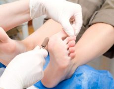 Κάλοι στα πόδια