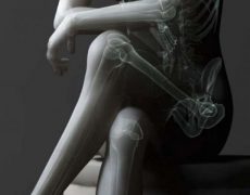 Σταυρώνετε τα πόδια σας όταν κάθεστε; Δείτε πώς επηρεάζει την υγεία σας