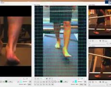 Σεμινάριo «Εμβιομηχανική Αξιολόγηση Άκρου Ποδός»