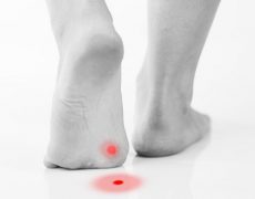 Κάλοι /τύλοι και οι μύθοι γύρω από αυτούς