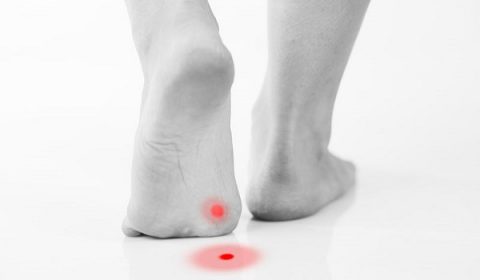 Κάλοι /τύλοι και οι μύθοι γύρω από αυτούς